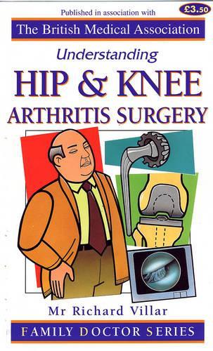 Understanding Hip and Knee Arthritis Surgery (Family Doctor Series)