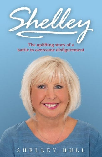 Shelley: The uplifting story of a battle to overcome disfigurement