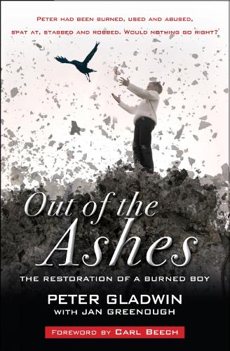 Out of Ashes: The Restoration of a Burned Boy