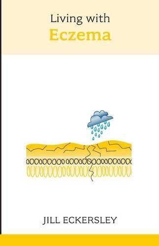 Living with Eczema (Overcoming Common Problems)