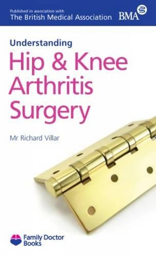Hip and Knee Arthritis Surgery (Understanding) (Family Doctor Books)