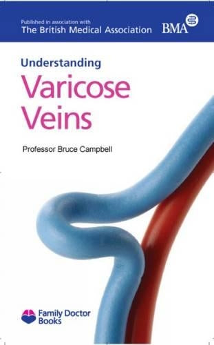 Varicose Veins (Understanding) (Family Doctor Books)