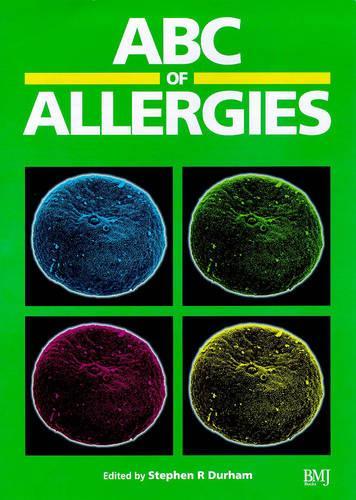 ABC of Allergies (ABC Series)