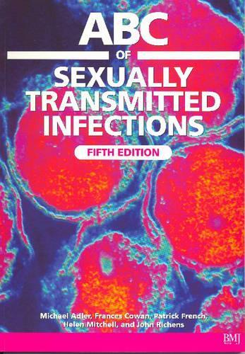 ABC of Sexually Transmitted Infections (ABC Series)