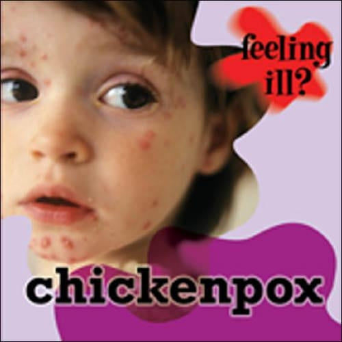 Chicken Pox (Feeling Ill?)